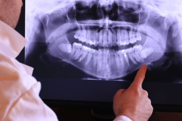 Best Emergency Dentist for Lost Fillings or Crowns in Fairview, OR