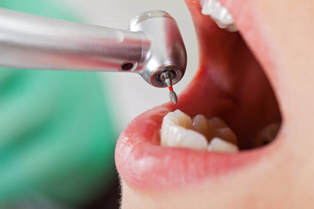 Best Emergency Dentist for Special Needs Patients in Fairview, OR